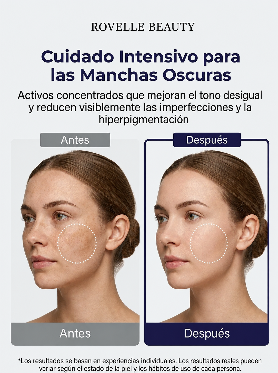Crema Unificante con Acido Tranexamico